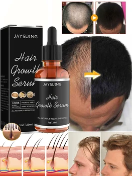 Масло для роста волос Быстрый Рост волос Эффективное Средство для лечения Облысения Наследственного Выпадения волос Послеродового Выпадения волос Себорейного Выпадения волос